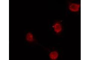 ABIN6274167 staining HuvEc cells by IF/ICC. (SKIL antibody  (C-Term))
