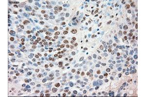 Immunohistochemical staining of paraffin-embedded Kidney tissue using anti-SIGLEC9mouse monoclonal antibody. (SIGLEC9 antibody)