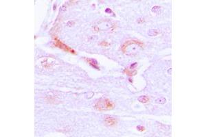 Immunohistochemical analysis of CABC1 staining in human brain formalin fixed paraffin embedded tissue section. (COQ8A antibody  (Center))