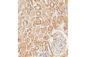 Immunohistochemistry (Paraffin-embedded Sections) (IHC (p)) image for anti-Ribosomal Protein S18 (RPS18) (AA 62-91) antibody (ABIN390874)