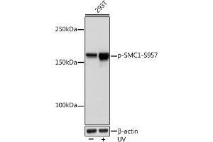 Western blot analysis of extracts of 293T cells, using Phospho-SMC1-S957 Rabbit mAb (ABIN7270613) at 1:1000 dilution. (SMC1A antibody  (pSer957))