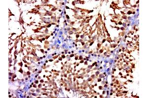 Paraformaldehyde-fixed, paraffin embedded mouse testis, Antigen retrieval by boiling in sodium citrate buffer (pH6. (CCDC146 antibody)