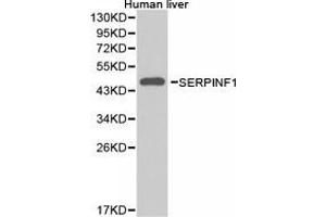 Western Blotting (WB) image for anti-serpin Peptidase Inhibitor, Clade F (Alpha-2 Antiplasmin, Pigment Epithelium Derived Factor), Member 1 (SERPINF1) antibody (ABIN1874740) (PEDF antibody)