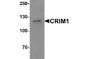 Western blot analysis of CRIM1 in Jurkat cell lysate with Crim1 antibody at 1 µg/mL.