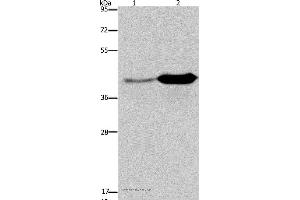 Western blot analysis of Mouse liver and brain tissue, using GLUL Polyclonal Antibody at dilution of 1:650