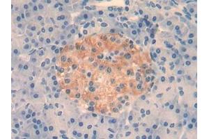 Detection of IL4 in Human Pancreas Tissue using Monoclonal Antibody to Interleukin 4 (IL4) (IL-4 antibody  (AA 25-153))
