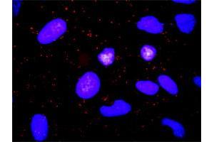 Proximity Ligation Analysis of protein-protein interactions between TGFA and ADAM17. (TGFA antibody  (AA 1-160))