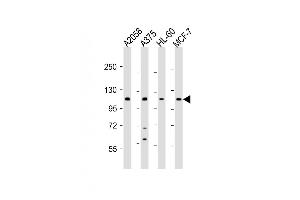 All lanes : Anti-COL17A1 Antibody (Center) at 1:2000 dilution Lane 1:  whole cell lysate Lane 2:  whole cell lysate Lane 3: HL-60 whole cell lysate Lane 4: MCF-7 whole cell lysate Lysates/proteins at 20 μg per lane. (COL17A1 antibody  (AA 475-504))