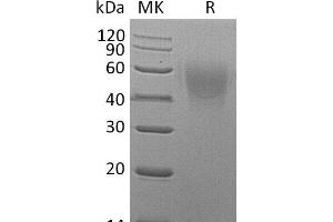 Western Blotting (WB) image for CD86 (CD86) protein (His tag) (ABIN7320769) (CD86 Protein (CD86) (His tag))