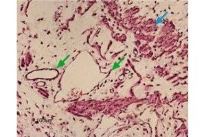 Expression of Kir6. (Potassium Inwardly-Rectifying Channel, Subfamily J, Member 8 (KCNJ8) Peptide)