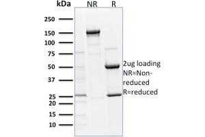 SDS-PAGE Analysis Purified p63 Mouse Monoclonal Antibody (TP63/1786). (p63 antibody  (AA 3-106))