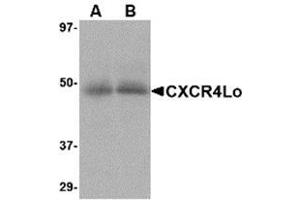Western Blotting (WB) image for anti-Chemokine (C-X-C Motif) Receptor 4 (CXCR4) (Isoform A), (N-Term) antibody (ABIN499700)