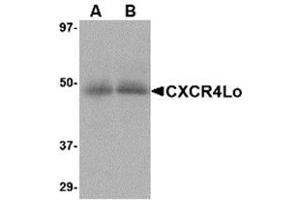 Western blot analysis of CXCR4 in (A) human spleen and (B) human thymus tissue lysate with AP30268PU-N CXCR4-Lo antibody at 10 μg/ml. (CXCR4 antibody  (Isoform A, N-Term))