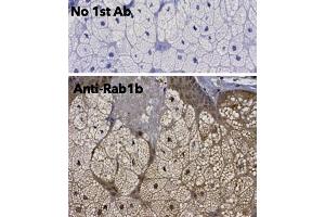 Immunohistochemistry (IHC) image for anti-RAB1B, Member RAS Oncogene Family (RAB1B) (C-Term) antibody (ABIN6254186) (RAB1B antibody  (C-Term))