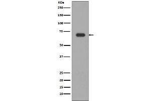 Western blot analysis of Alas1 expression in HepG2 cell lysate. (Recombinant ALAS1 antibody)