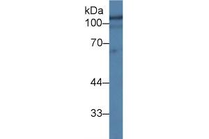 Western Blotting (WB) image for anti-Hexosaminidase B (Beta Polypeptide) (HEXB) (AA 122-311) antibody (ABIN7438553)