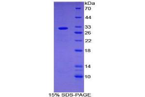 SDS-PAGE analysis of Mouse SHB Protein. (Src Homology 2 Domain Containing Adapter Protein B Protein)