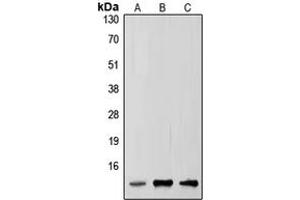 Western blot analysis of SUMO2/3 expression in HepG2 (A), mouse brain (B), rat brain (C) whole cell lysates. (SUMO2/3 antibody  (Center))