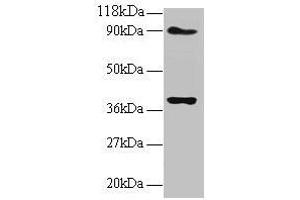 Western blot All lanes: NDUFS5 antibody at 2 μg/mL Lane 1: EC109 whole cell lysate Lane 2: 293T whole cell lysate Secondary Goat polyclonal to rabbit IgG at 1/15000 dilution Predicted band size: 13 kDa Observed band size: 40 kDa (NDUFS5 antibody  (AA 2-106))
