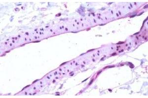 Human, Vascular Endothelium: Formalin-Fixed Paraffin-Embedded (FFPE) (S1PR1 antibody  (Cytoplasmic Domain))