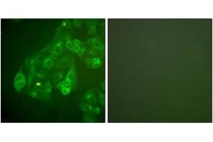 Immunofluorescence analysis of A549 cells, using Connexin 43 Antibody. (Connexin 43/GJA1 antibody  (AA 333-382))