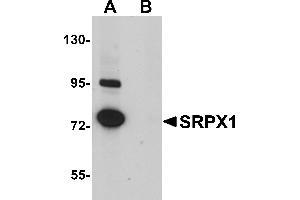 Western Blotting (WB) image for anti-Sushi-Repeat Containing Protein, X-Linked (SRPX) (N-Term) antibody (ABIN1031585) (SRPX antibody  (N-Term))