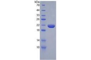 SDS-PAGE of Protein Standard from the Kit (Highly purified E. (TNF alpha ELISA Kit)