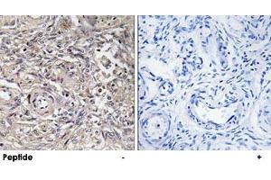 Immunohistochemistry analysis of paraffin-embedded human ovary tissue using CLDN6 polyclonal antibody .