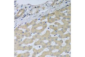 Immunohistochemistry of paraffin-embedded human liver injury using ATAD3B antibody at dilution of 1:100 (x40 lens).