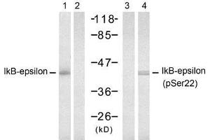 Western blot analysis of extract from 293 cells, untreated or treated with TNF-α (20ng/ml, 15min), using IkB-ε (Ab-22) antibody (E021296, Lane 1 and 2) and IkB-ε (Phospho-Ser22) antibody (E011213, Lane 3 and 4). (NFKBIE antibody)