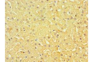 Immunohistochemistry of paraffin-embedded human liver tissue using ABIN7151877 at dilution of 1:100 (Ephrin B1 antibody  (AA 28-237))