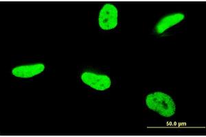 Immunofluorescence of monoclonal antibody to TAF12 on HeLa cell. (TAF12 antibody  (AA 1-161))