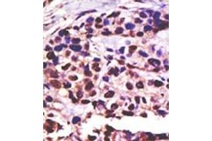 Image no. 2 for anti-Ubiquitin Specific Peptidase 25 (USP25) (C-Term) antibody (ABIN357563) (USP25 antibody  (C-Term))