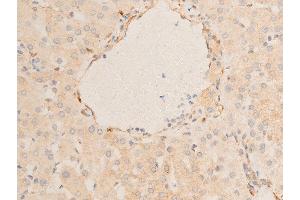 Immunohistochemistry (IHC) image for anti-Heat Shock Protein, alpha-Crystallin-Related, B6 (HSPB6) (pSer16) antibody (ABIN6256161)