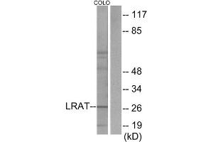Western Blotting (WB) image for anti-Lecithin Retinol Acyltransferase (Phosphatidylcholine--Retinol O-Acyltransferase) (LRAT) (Internal Region) antibody (ABIN1849060) (LRAT antibody  (Internal Region))