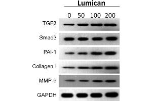Lumican promotes the expression of protein level in fibrosis. (MMP 9 antibody  (AA 538-707))