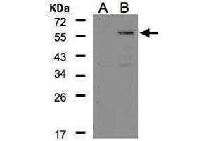 WB Image Western Blot analysis of CPE expression in transfected 293T cell line by CPE polyclonal antibody. (CPE antibody)