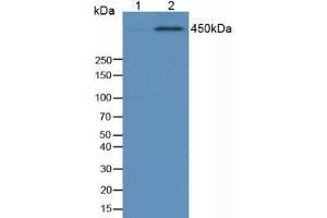 Detection of TP53BP1 in Human 293 Cells using Anti-Phosphorylated Tumor Protein p53 Binding Protein 1 (TP53BP1) Polyclonal Antibody (TP53BP1 antibody  (pSer1778))