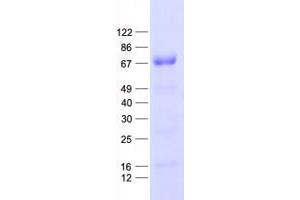 Validation with Western Blot