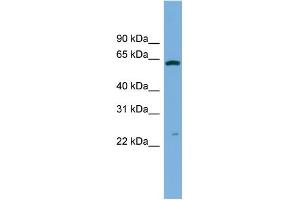 WB Suggested Anti-GSTA3 Antibody Titration:  0. (GSTA3 antibody  (Middle Region))