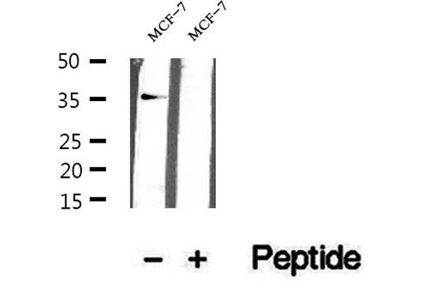 KCTD12 antibody  (Internal Region)