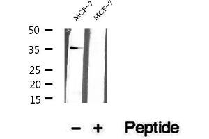 Western blot analysis of extracts of MCF-7 cells, using KCTD12 antibody.