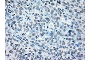 Immunohistochemistry (IHC) image for anti-Interferon Regulatory Factor 3 (IRF3) antibody (ABIN2723790)