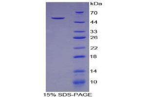 SDS-PAGE (SDS) image for alpha 1 Microglobulin/bikunin precursor (AMBP) (AA 18-202) protein (His tag,GST tag) (ABIN1879913) (AMBP Protein (AA 18-202) (His tag,GST tag))