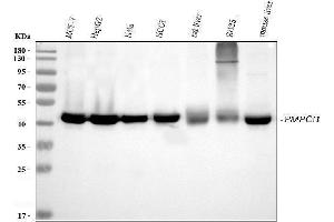 Western blot analysis of PMPCB using anti-PMPCB antibody (ABIN7600757).