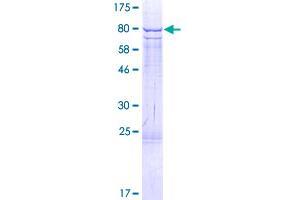 RPS6KB2 Protein (AA 1-482) (GST tag)