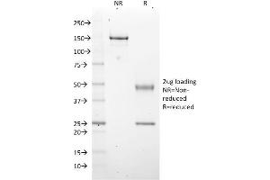 SDS-PAGE Analysis Purified EZH2 / KMT6 Mouse Monoclonal Antibody (EZH2/2536). (EZH2 antibody)