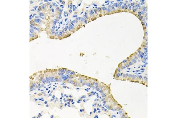 STRN3 antibody  (AA 200-460)