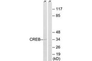 Western blot analysis of extracts from Jurkat cells, using CREB (Ab-100) Antibody. (CREB1 antibody  (AA 71-120))