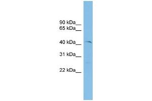 WB Suggested Anti-ETV7 Antibody Titration: 0. (ETV7 antibody  (N-Term))